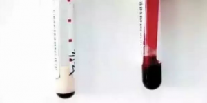 乳糜血只能当废血？