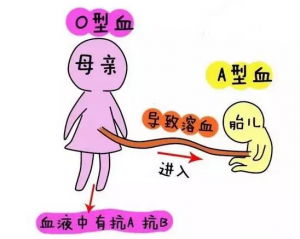 溶血症